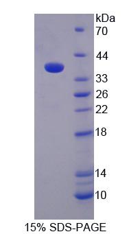 CASC1 Protein - Recombinant Cancer Susceptibility Candidate 1 (CASC1) by SDS-PAGE