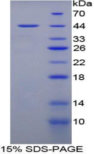 CCL28 / MEC Protein - Recombinant Mucosae Associated Epithelia Chemokine By SDS-PAGE