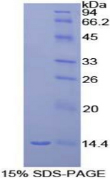 Ccl9 / MIP-1 Gamma Protein - Recombinant Macrophage Inflammatory Protein 1 Gamma By SDS-PAGE