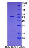 CCN5 Protein