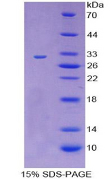 CD109 Protein - Recombinant Cluster Of Differentiation 109 By SDS-PAGE