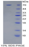 CD14 Protein - Recombinant Cluster Of Differentiation 14 By SDS-PAGE