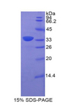CD157 Protein - Recombinant Bone Marrow Stromal Cell Antigen 1 By SDS-PAGE
