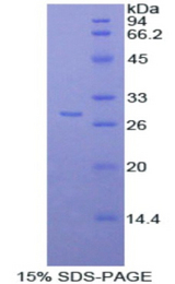 CD163 Protein - Recombinant  Cluster Of Differentiation By SDS-PAGE