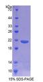 CD164 Protein - Recombinant  Cluster Of Differentiation 164 By SDS-PAGE