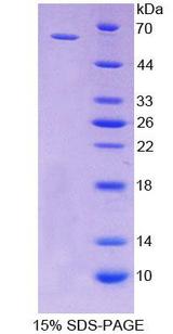 CD19 Protein - Recombinant  Cluster Of Differentiation 19 By SDS-PAGE