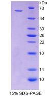 CD19 Protein - Recombinant  Cluster Of Differentiation 19 By SDS-PAGE