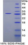 CD244 Protein - Recombinant Natural Killer Cell Receptor 2B4 By SDS-PAGE