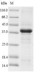 CD300LF / CD300f Protein - (Tris-Glycine gel) Discontinuous SDS-PAGE (reduced) with 5% enrichment gel and 15% separation gel.
