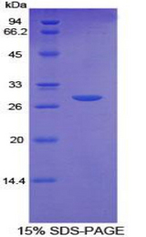 CD36 Protein - Recombinant Platelet Membrane Glycoprotein IV By SDS-PAGE