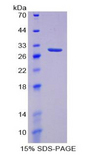CD38 Protein - Recombinant Cyclic ADP Ribose Hydrolase By SDS-PAGE
