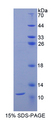 CD3D Protein - Recombinant Cluster Of Differentiation 3d By SDS-PAGE