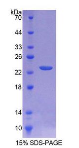 CD40 Protein - Recombinant  Tumor Necrosis Factor Receptor Superfamily, Member 5 By SDS-PAGE