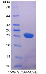 CD6 Protein - Recombinant Cluster Of Differentiation 6 By SDS-PAGE