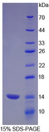 CD66a / CEACAM1 Protein - Recombinant Carcinoembryonic Antigen Related Cell Adhesion Molecule 1 By SDS-PAGE