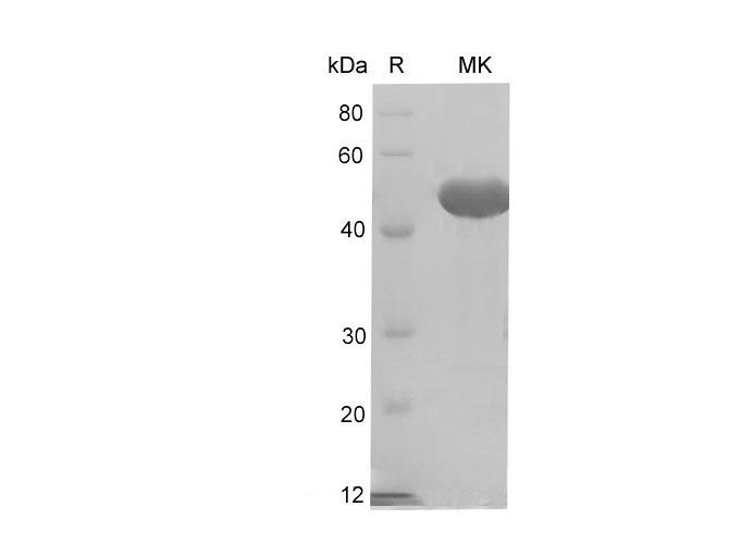CD66a / CEACAM1 Protein - Recombinant Rat Ceacam1/BGP-1 protein (His Tag)
