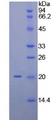 CD69 Protein - Recombinant C-Type Lectin Domain Family 2, Member C By SDS-PAGE