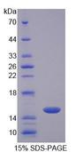 CD7 Protein - Recombinant Cluster Of Differentiation 7 By SDS-PAGE