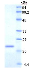 CD71 / Transferrin Receptor Protein - Recombinant Transferrin Receptor By SDS-PAGE