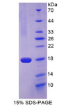 CD99 Protein - Recombinant Cluster Of Differentiation 99 By SDS-PAGE