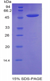 CDH13 / Cadherin 13 Protein - Recombinant Cadherin, Heart By SDS-PAGE
