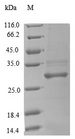 CFD / Factor D / Adipsin Protein - (Tris-Glycine gel) Discontinuous SDS-PAGE (reduced) with 5% enrichment gel and 15% separation gel.