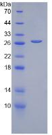 CFD / Factor D / Adipsin Protein - Recombinant Complement Factor D By SDS-PAGE