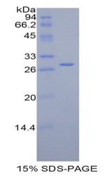 CFH / Complement Factor H Protein - Recombinant Complement Factor H By SDS-PAGE