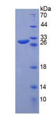 CHI3L1 / YKL-40 Protein - Recombinant  Glycoprotein 39, Cartilage By SDS-PAGE
