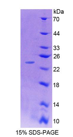 CHN2 / Chimerin 2 Protein - Recombinant Chimerin 2 By SDS-PAGE
