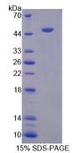 CHRNA10 Protein - Recombinant Cholinergic Receptor, Nicotinic, Alpha 10 (CHRNa10) by SDS-PAGE