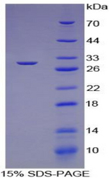 CMA1 / Mast Cell Chymase Protein - Recombinant Chymase 1, Mast Cell By SDS-PAGE