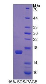 CNR1 / CB1 Protein - Recombinant Cannabinoid Receptor 1, Brain By SDS-PAGE