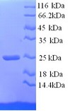 COL1A1 / Collagen I Alpha 1 Protein