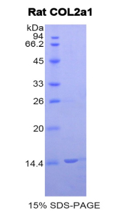 COL2A1 / Collagen II Alpha 1 Protein - Recombinant  Collagen Type II Alpha 1 By SDS-PAGE