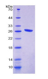 Complement C1QA Protein - Recombinant Complement Component 1, Q Subcomponent A By SDS-PAGE