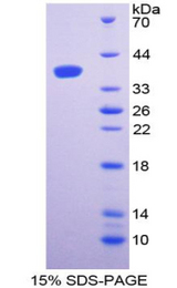 Complement C3 Protein - Recombinant Complement Component 3 By SDS-PAGE