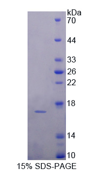 Complement C7 Protein - Recombinant  Complement Component 7 By SDS-PAGE