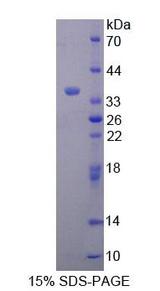 Complement C8A Protein - Recombinant Complement Component 8a (C8a) by SDS-PAGE