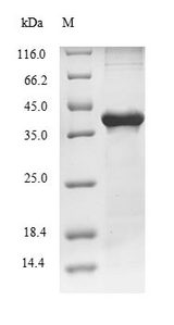 CPA1 / Carboxypeptidase A Protein - (Tris-Glycine gel) Discontinuous SDS-PAGE (reduced) with 5% enrichment gel and 15% separation gel.