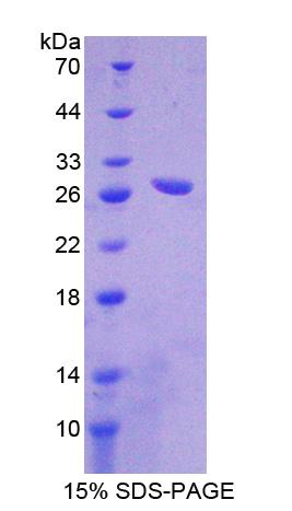 CPA1 / Carboxypeptidase A Protein - Recombinant  Carboxypeptidase A1, Pancreatic By SDS-PAGE