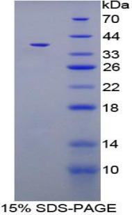 CPB / Carboxypeptidase B Protein - Recombinant Carboxypeptidase B1, Tissue By SDS-PAGE