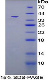 CPB / Carboxypeptidase B Protein - Recombinant Carboxypeptidase B1, Tissue By SDS-PAGE