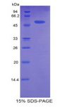 CPT1A Protein - Recombinant Carnitine Palmitoyltransferase 1A, Liver By SDS-PAGE