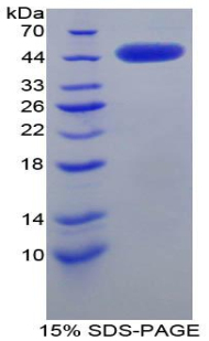 CRH / CRF Protein - Recombinant Corticotropin Releasing Hormone By SDS-PAGE