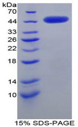 CRH / CRF Protein - Recombinant Corticotropin Releasing Hormone By SDS-PAGE