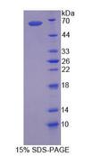 CRHBP Protein - Recombinant  Corticotropin Releasing Hormone Binding Protein By SDS-PAGE