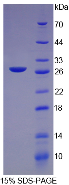CRP / C-Reactive Protein Protein - Recombinant C Reactive Protein By SDS-PAGE