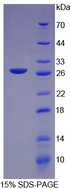 CRP / C-Reactive Protein Protein - Recombinant C Reactive Protein By SDS-PAGE