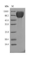 CRY2 Protein - (Tris-Glycine gel) Discontinuous SDS-PAGE (reduced) with 5% enrichment gel and 15% separation gel.